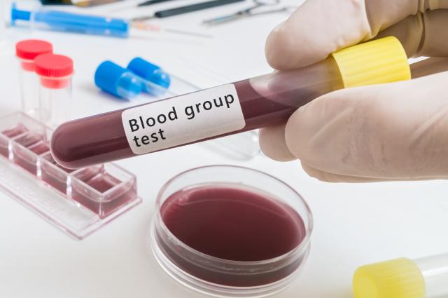 Analiza krvi umesto biopsije